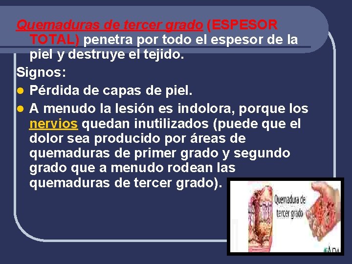 Quemaduras de tercer grado (ESPESOR TOTAL) penetra por todo el espesor de la piel