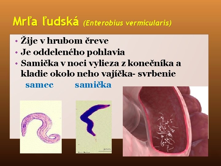 Mrľa ľudská (Enterobius vermicularis) • Žije v hrubom čreve • Je oddeleného pohlavia •