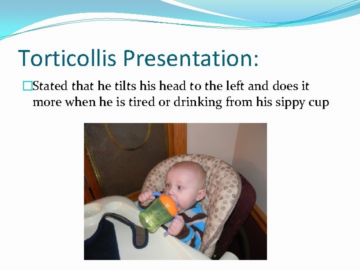 Torticollis Presentation: �Stated that he tilts his head to the left and does it