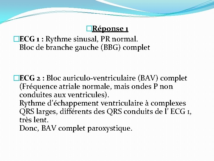 �Réponse 1 �ECG 1 : Rythme sinusal, PR normal. Bloc de branche gauche (BBG)