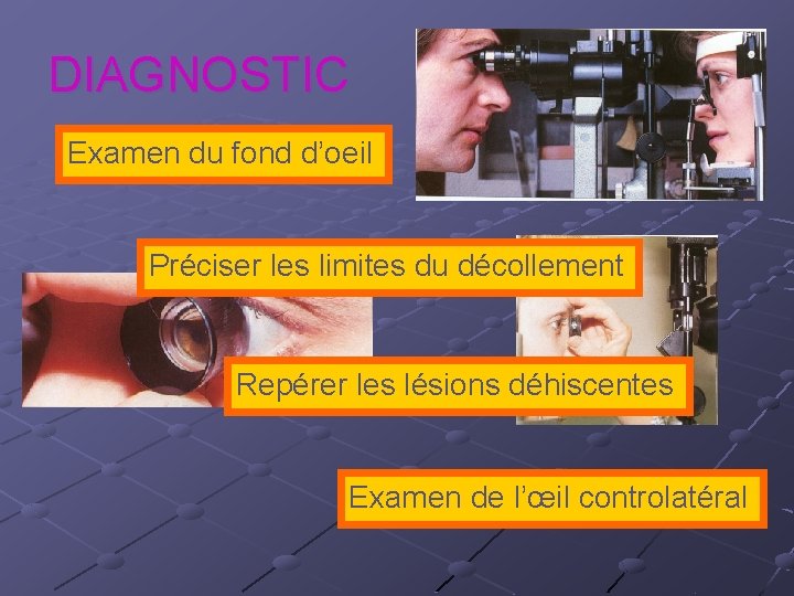 DIAGNOSTIC Examen du fond d’oeil Préciser les limites du décollement Repérer les lésions déhiscentes