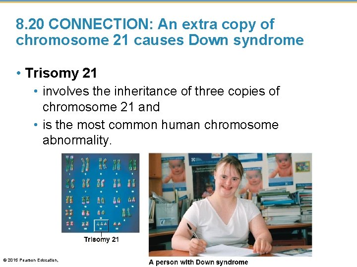 8. 20 CONNECTION: An extra copy of chromosome 21 causes Down syndrome • Trisomy