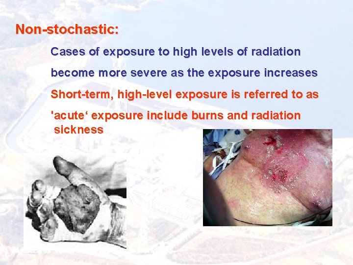 Non-stochastic: Cases of exposure to high levels of radiation become more severe as the