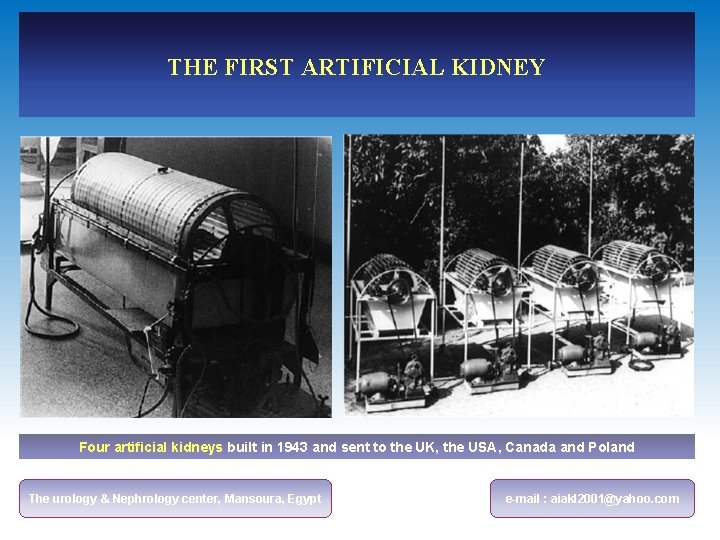 THE FIRST ARTIFICIAL KIDNEY Four artificial kidneys built in 1943 and sent to the