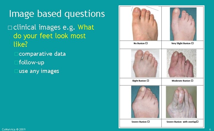 Image based questions � clinical images e. g. What do your feet look most