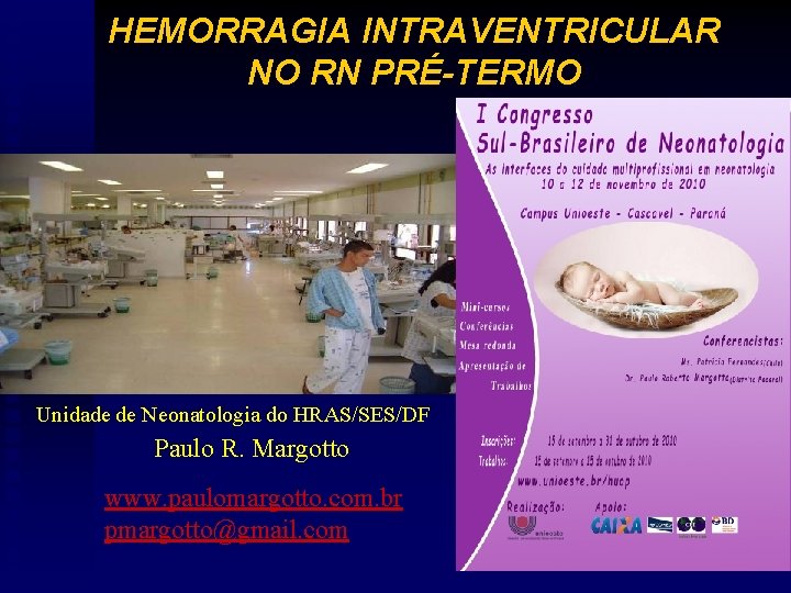 HEMORRAGIA INTRAVENTRICULAR NO RN PRÉ-TERMO Unidade de Neonatologia do HRAS/SES/DF Paulo R. Margotto www.