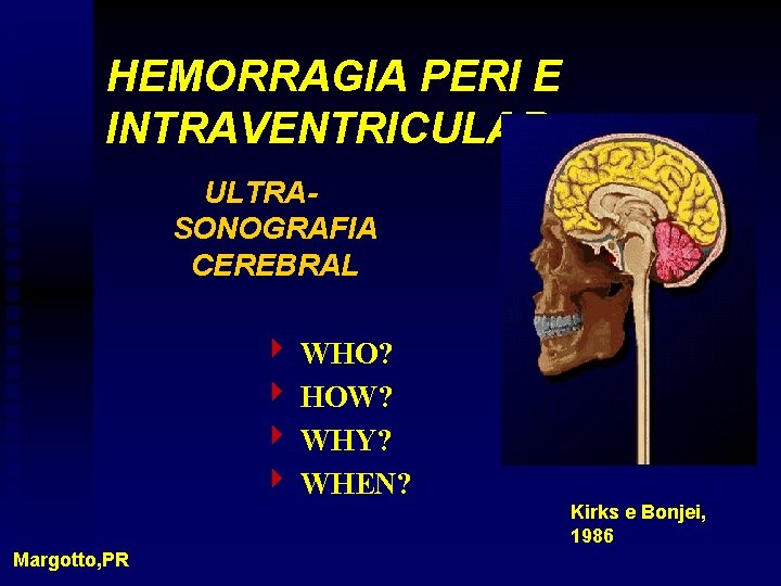 HEMORRAGIA PERI E INTRAVENTRICULAR ULTRASONOGRAFIA CEREBRAL 4 WHO? 4 HOW? 4 WHY? 4 WHEN?