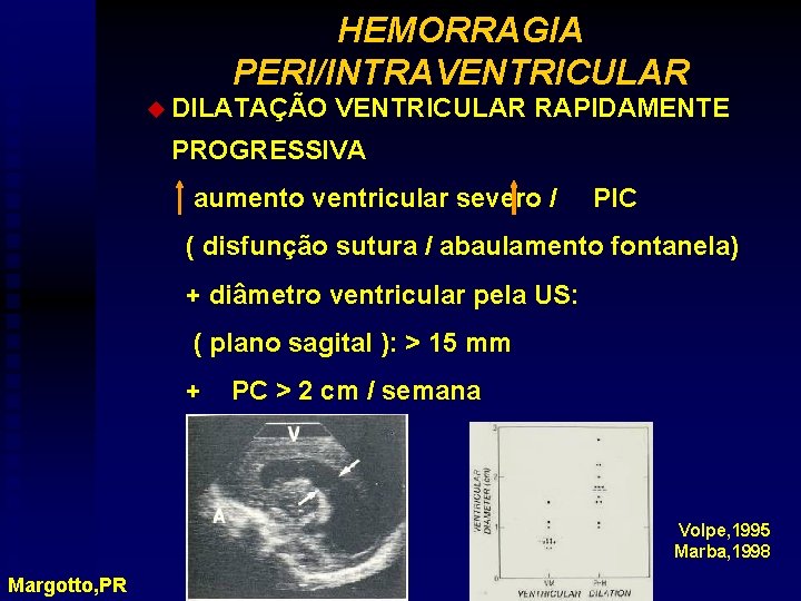 HEMORRAGIA PERI/INTRAVENTRICULAR u DILATAÇÃO VENTRICULAR RAPIDAMENTE PROGRESSIVA aumento ventricular severo / PIC ( disfunção