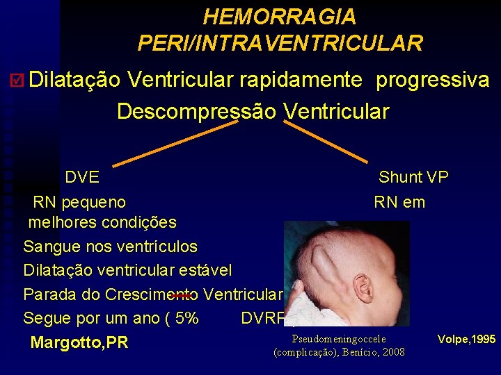 HEMORRAGIA PERI/INTRAVENTRICULAR þ Dilatação Ventricular rapidamente progressiva Descompressão Ventricular DVE Shunt VP RN pequeno