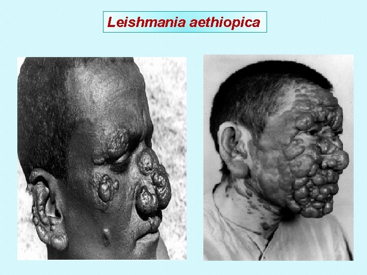 Leishmania aethiopica 