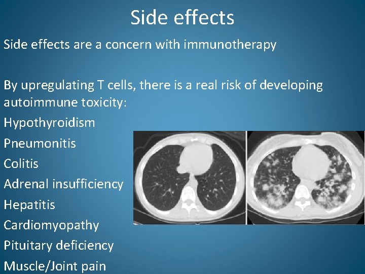 Side effects are a concern with immunotherapy By upregulating T cells, there is a