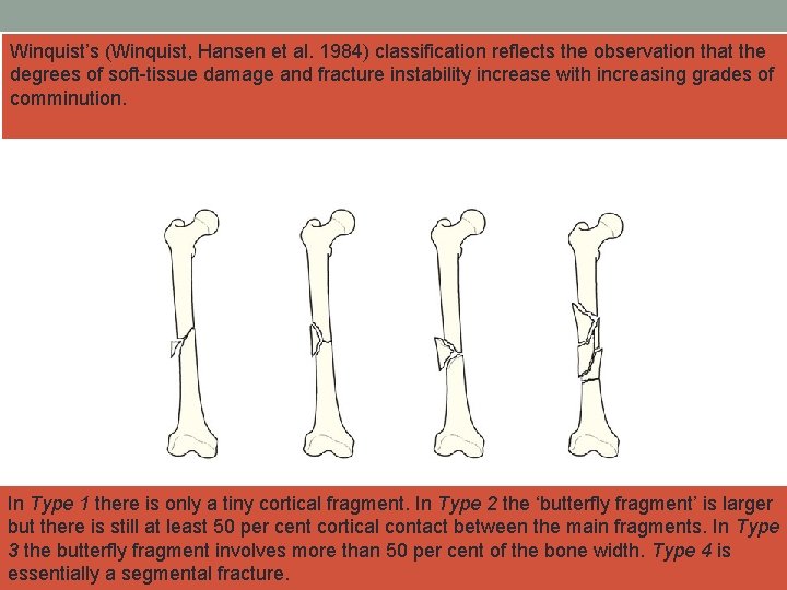 Winquist’s (Winquist, Hansen et al. 1984) classification reflects the observation that the degrees of