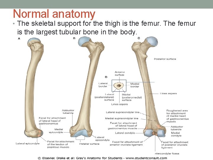 Normal anatomy • The skeletal support for the thigh is the femur. The femur