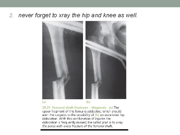 2. never forget to xray the hip and knee as well. 