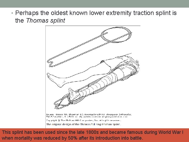  • Perhaps the oldest known lower extremity traction splint is the Thomas splint