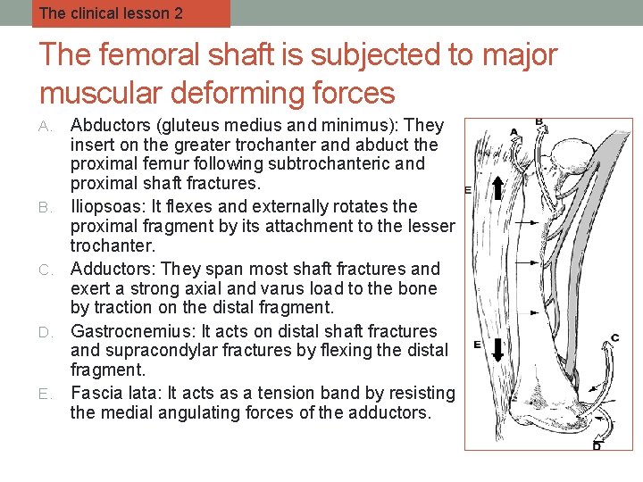 The clinical lesson 2 The femoral shaft is subjected to major muscular deforming forces