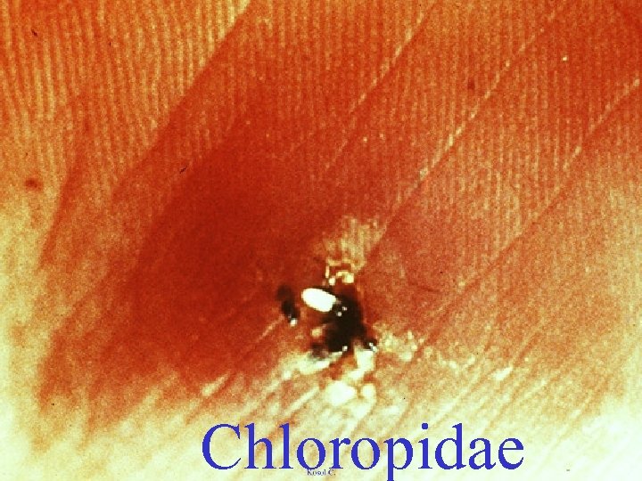 Chloropidae 