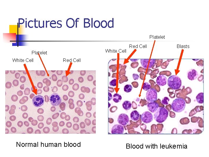 Pictures Of Blood Platelet White Cell Red Cell Blasts Red Cell Normal human blood