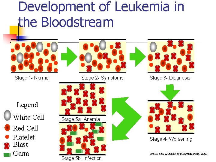 Development of Leukemia in the Bloodstream Stage 1 - Normal Stage 2 - Symptoms