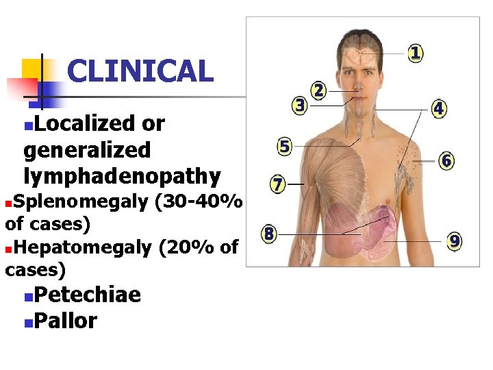 CLINICAL Localized or generalized lymphadenopathy n Splenomegaly (30 -40% of cases) n. Hepatomegaly (20%