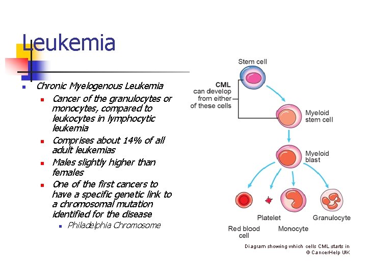 Leukemia n Chronic Myelogenous Leukemia n Cancer of the granulocytes or monocytes, compared to