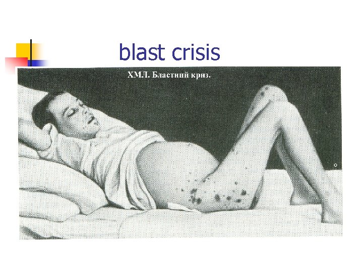 blast crisis 