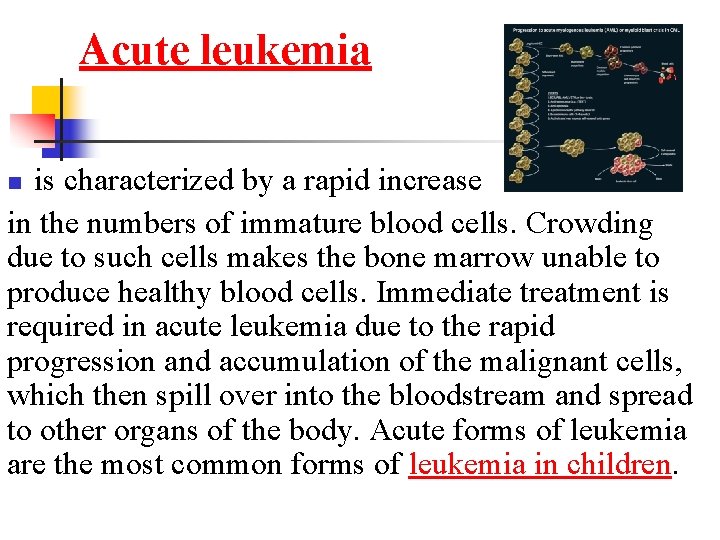 Acute leukemia is characterized by a rapid increase in the numbers of immature blood