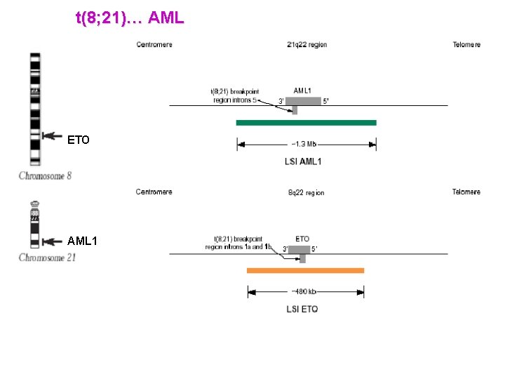 t(8; 21)… AML ETO AML 1 t(8; 21)… AML ETO AML 1