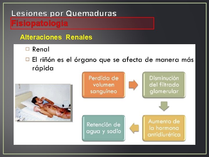 Lesiones por Quemaduras Fisiopatología Alteraciones Renales Lesiones por Quemaduras Fisiopatología Alteraciones Renales