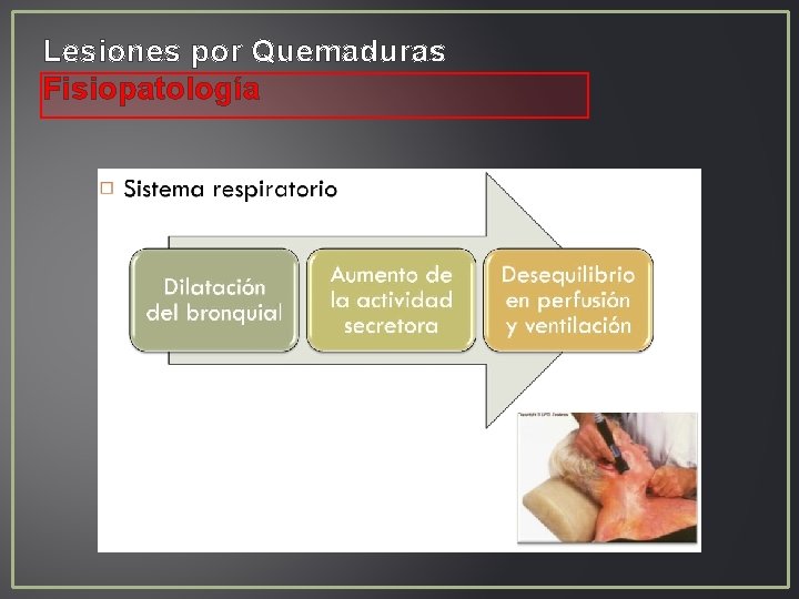 Lesiones por Quemaduras Fisiopatología Lesiones por Quemaduras Fisiopatología