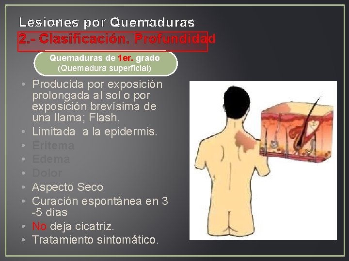 Lesiones por Quemaduras 2. - Clasificación. Profundidad Quemaduras de 1 er. grado (Quemadura superficial) Lesiones por Quemaduras 2. - Clasificación. Profundidad Quemaduras de 1 er. grado (Quemadura superficial)
