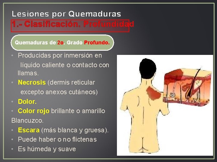 Lesiones por Quemaduras 1. - Clasificación. Profundidad Quemaduras de 2 o. Grado Profundo. • Lesiones por Quemaduras 1. - Clasificación. Profundidad Quemaduras de 2 o. Grado Profundo. •