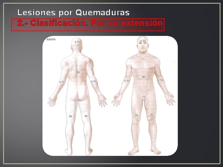 Lesiones por Quemaduras 2. - Clasificación. Por su extensión Lesiones por Quemaduras 2. - Clasificación. Por su extensión