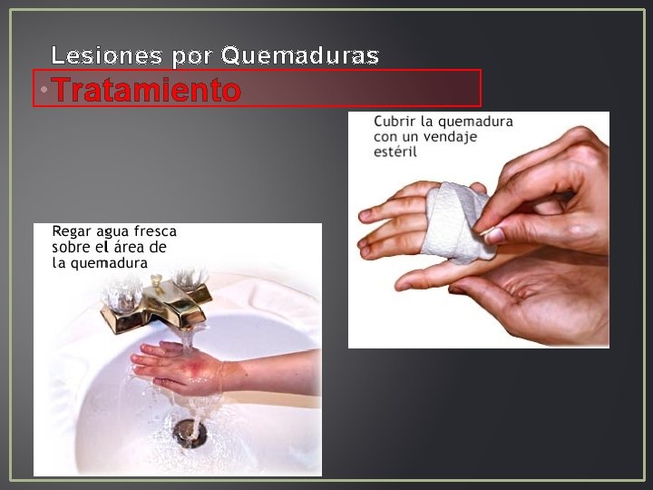 Lesiones por Quemaduras • Tratamiento Lesiones por Quemaduras • Tratamiento