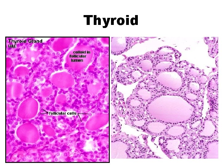 Thyroid 