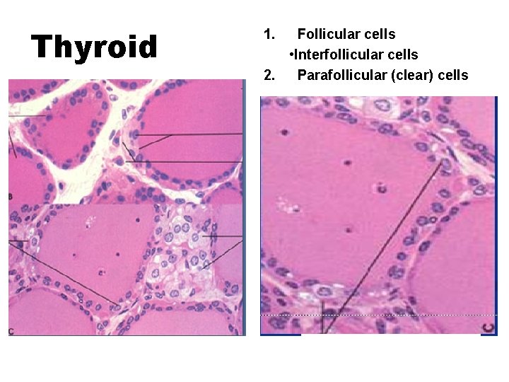 Thyroid 1. Follicular cells • Interfollicular cells 2. Parafollicular (clear) cells 