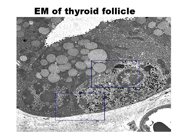 EM of thyroid follicle 