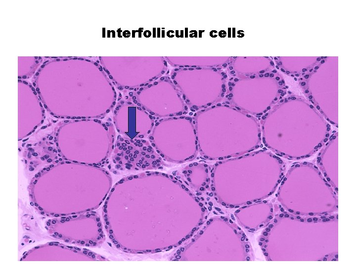 Interfollicular cells 