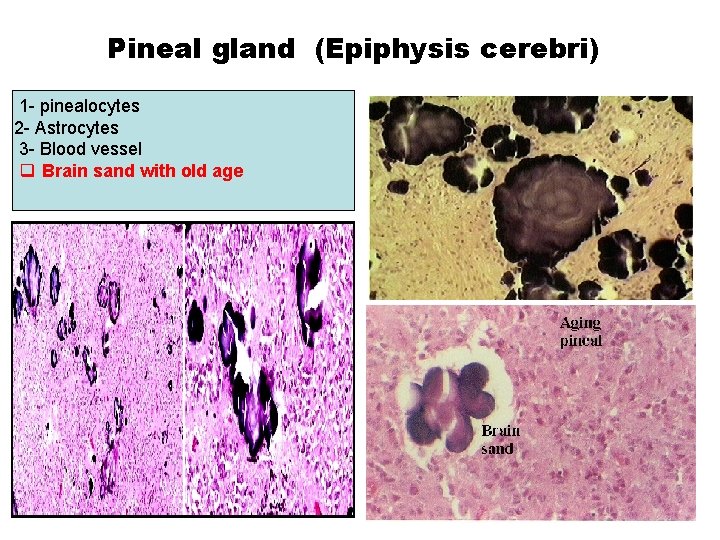 Pineal gland (Epiphysis cerebri) 1 - pinealocytes 2 - Astrocytes 3 - Blood vessel