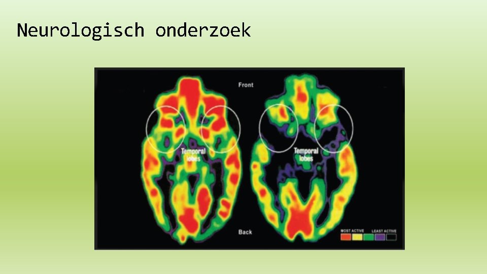 Neurologisch onderzoek 