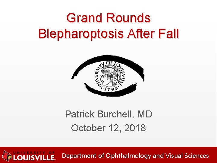 Grand Rounds Blepharoptosis After Fall Patrick Burchell, MD October 12, 2018 Department of Ophthalmology