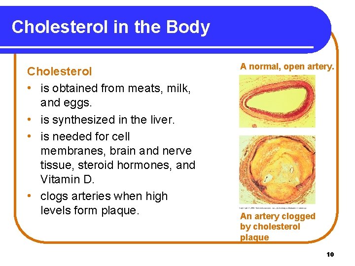 Cholesterol in the Body Cholesterol • is obtained from meats, milk, and eggs. •
