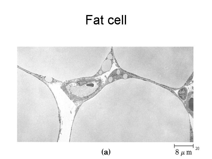 Fat cell 20 
