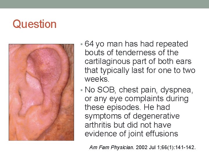 Question • 64 yo man has had repeated bouts of tenderness of the cartilaginous