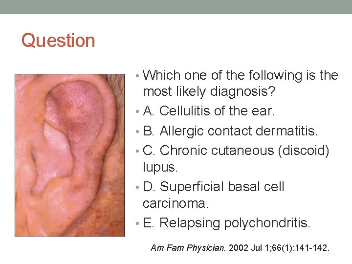 Question • Which one of the following is the most likely diagnosis? • A.