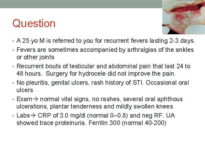 Question • A 25 yo M is referred to you for recurrent fevers lasting