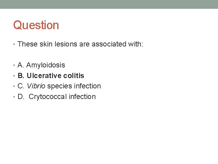 Question • These skin lesions are associated with: • A. Amyloidosis • B. Ulcerative