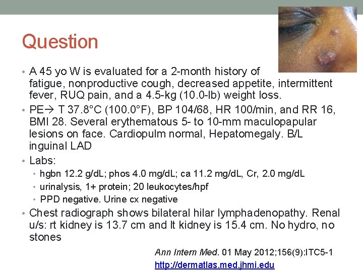 Question • A 45 yo W is evaluated for a 2 -month history of