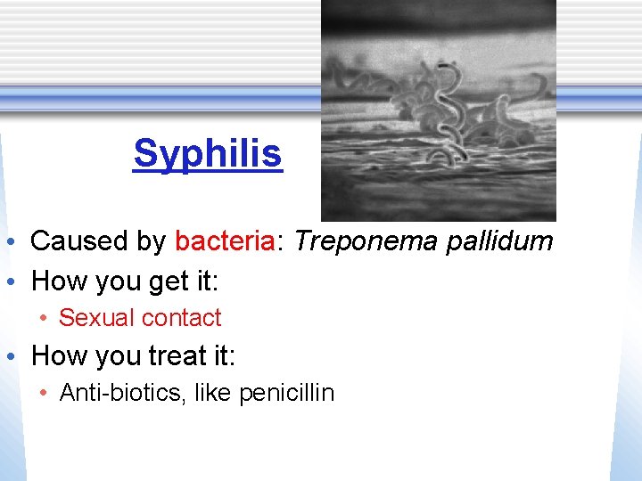 Syphilis • Caused by bacteria: Treponema pallidum • How you get it: • Sexual