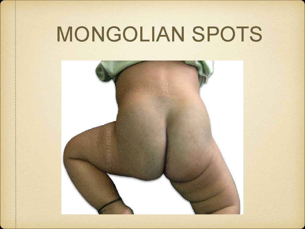 MONGOLIAN SPOTS 